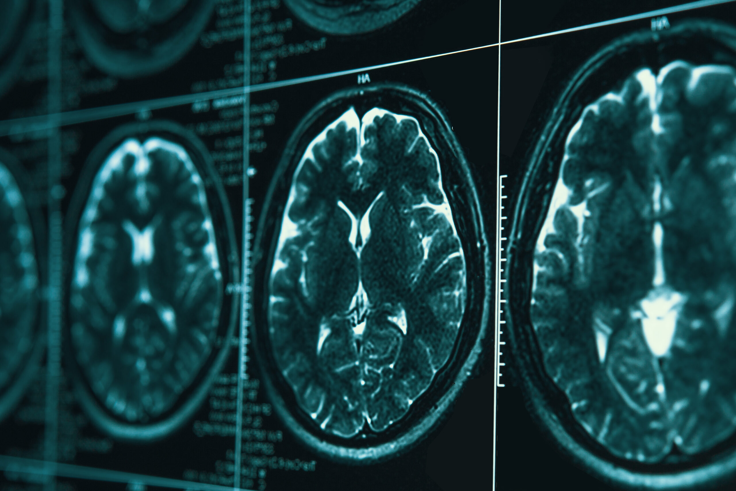 Magnetic resonance