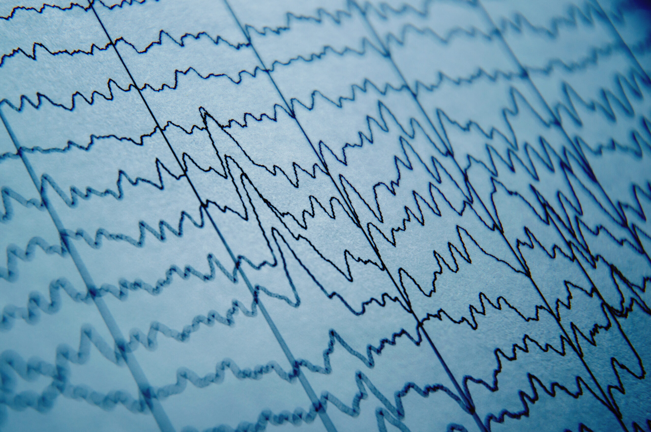 EEG wave 